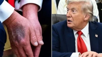 ترامب يخضع لفحص الرنين المغناطيسي والبيت الأبيض يلتزم الصمت حول الأسباب الحقيقية